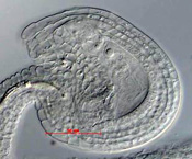 Whole-mount preparation showing an unfertilized mature embryo sac 